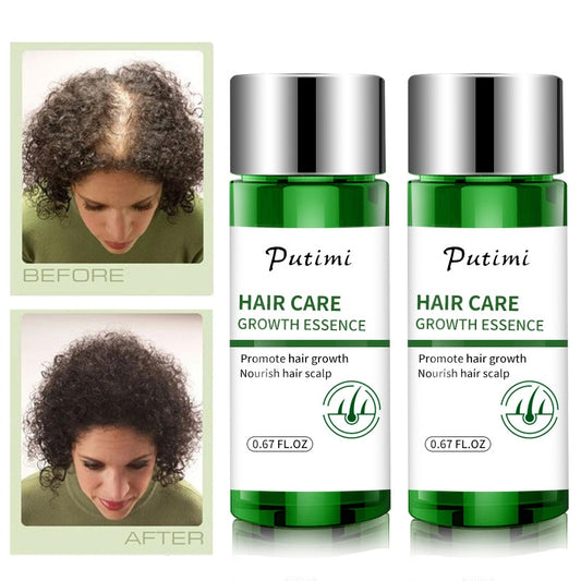 Hair Care Hair Growth Essential Oils Essence Hair Loss Liquid Health Care Beauty Dense Hair Growth Serum Restoration Essence